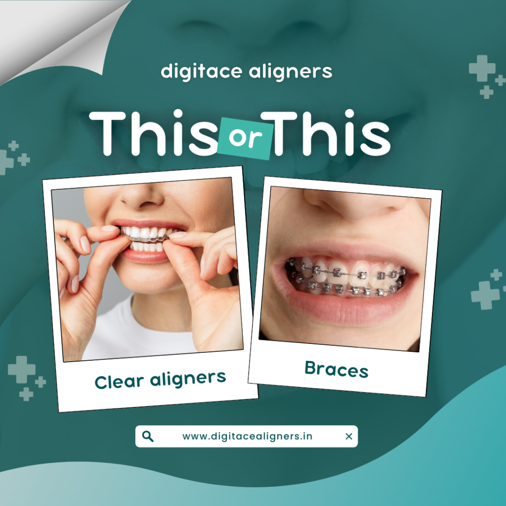 Clear Aligner in Kerala