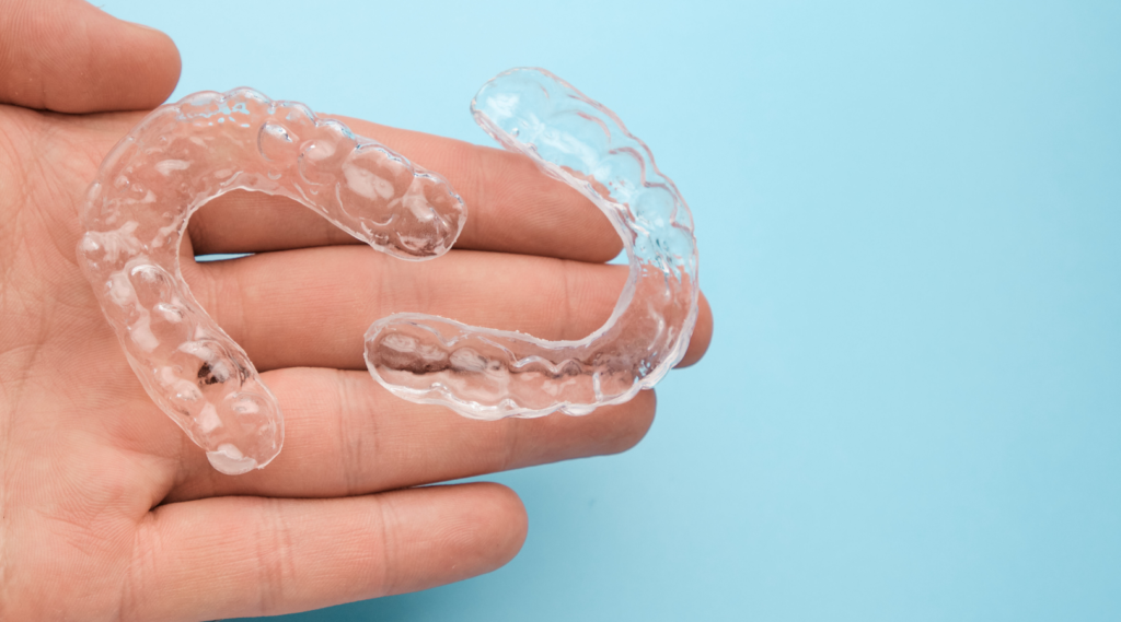 Clear Aligner Costs in Kerala